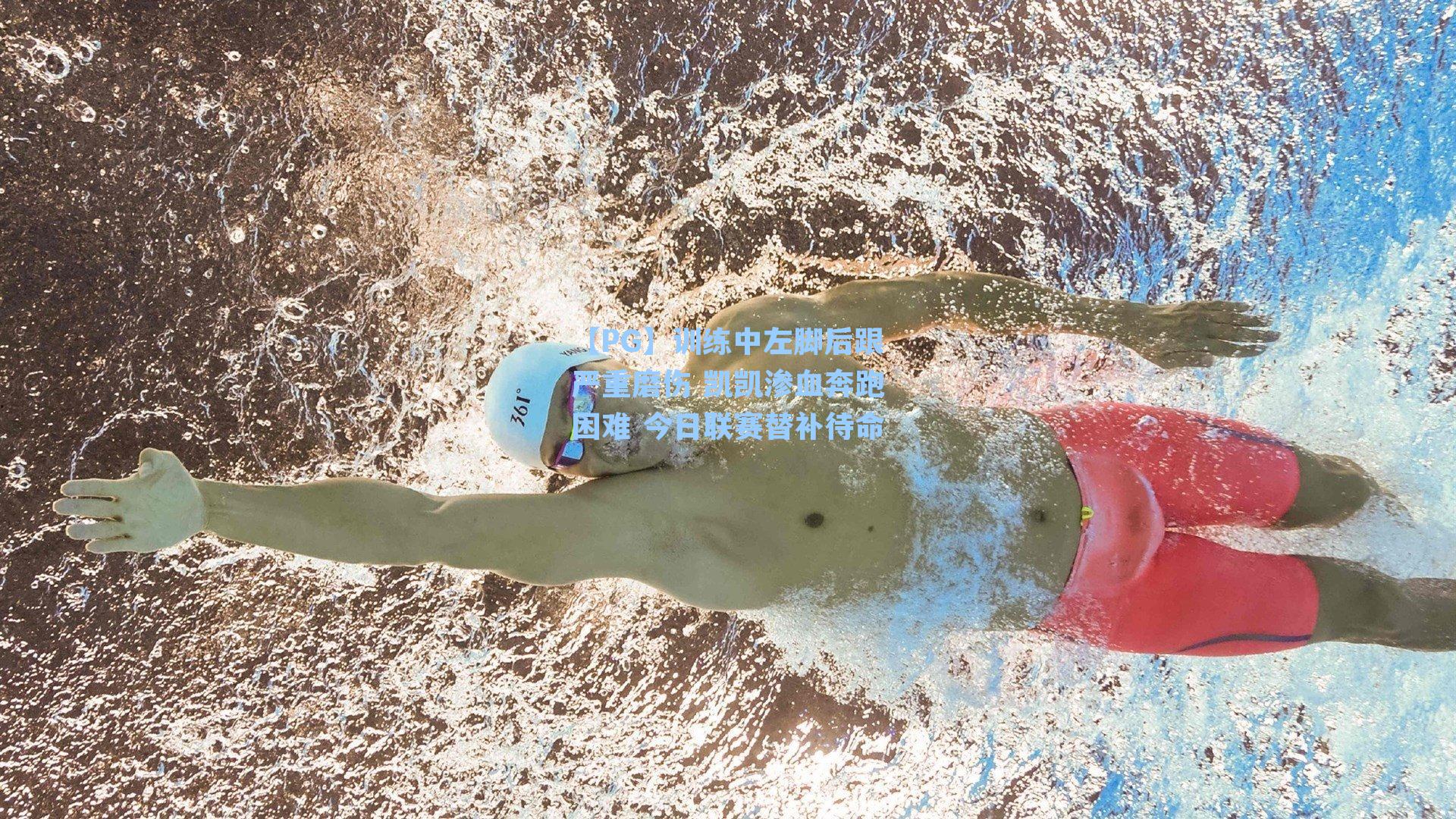 训练中左脚后跟严重磨伤 凯凯渗血奔跑困难 今日联赛替补待命